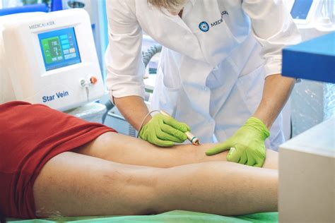 Tratamentul cu laser al varicelor în costul Minsk
